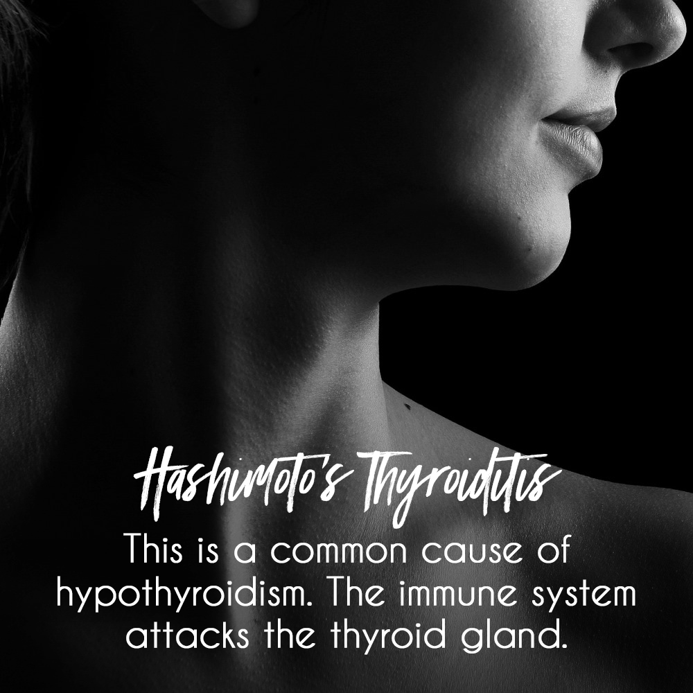 Understanding Hashimoto’s Thyroiditis: Symptoms, Causes, and&nbsp;Treatments