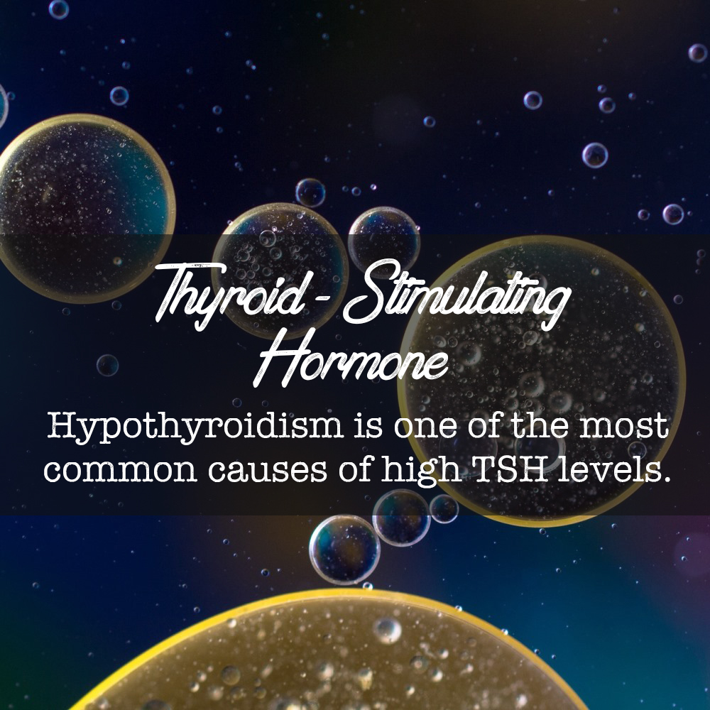 Understanding TSH Levels: A Key Indicator of&nbsp;Hypothyroidism
